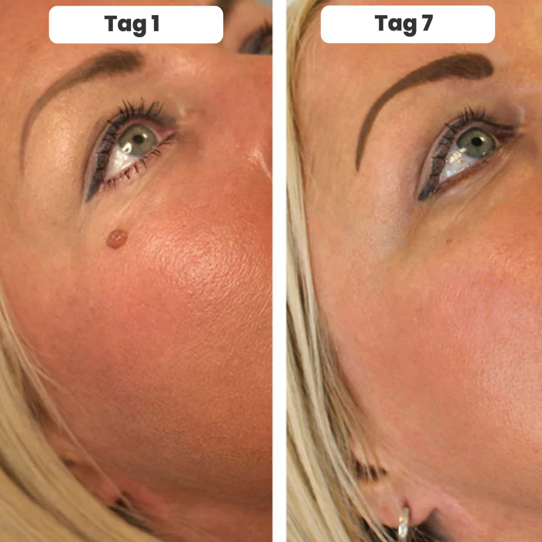 DermaTag™ (Kopya)