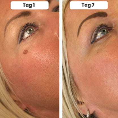 DermaTag™ (Kopya)